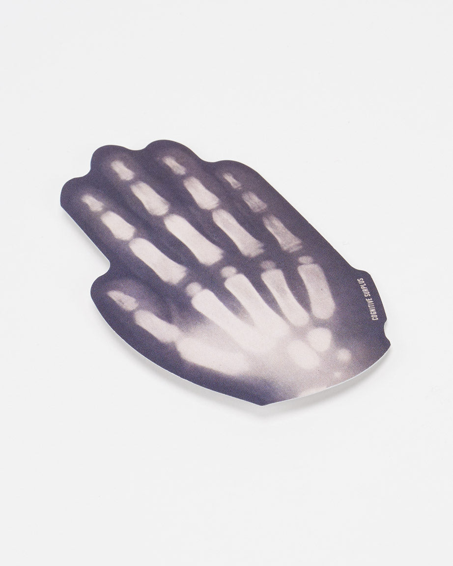 StXrayHand_01_cf611462-7913-4cb2-8875-a8c515dcdf77.jpg