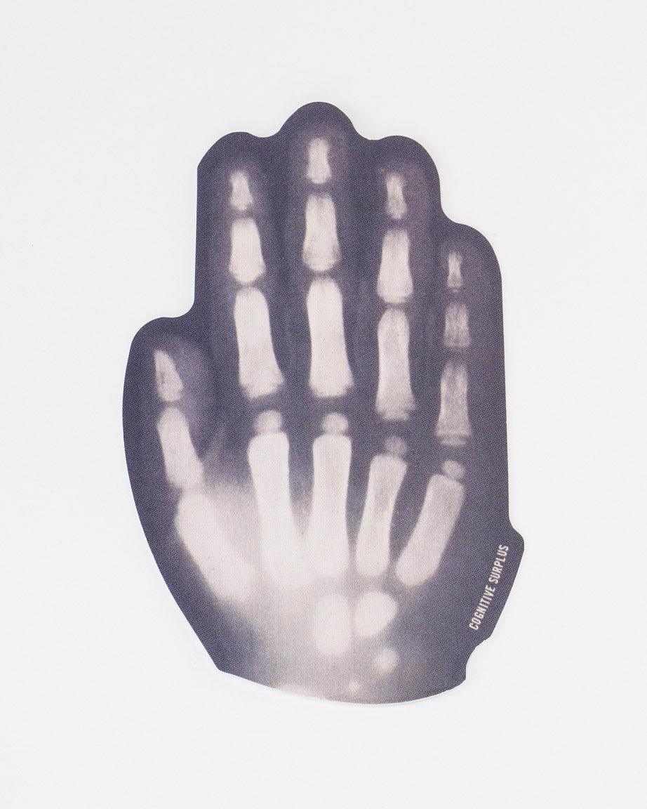 StXrayHand_02_7ceb9d6b-a734-49fe-8ed3-93728922c7db.jpg