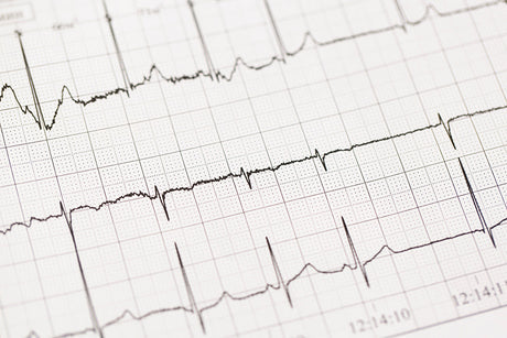 close-up-of-ecg-electrocardiogram-the-work-of-a-2021-12-27-21-30-40-utc.jpg