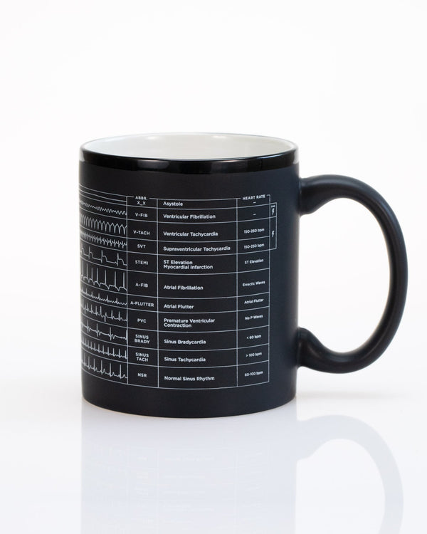 Heartbeat Mug | Anatomy Gift | Cognitive Surplus