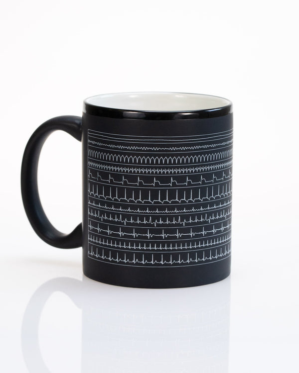 Heartbeat Mug | Anatomy Gift | Cognitive Surplus