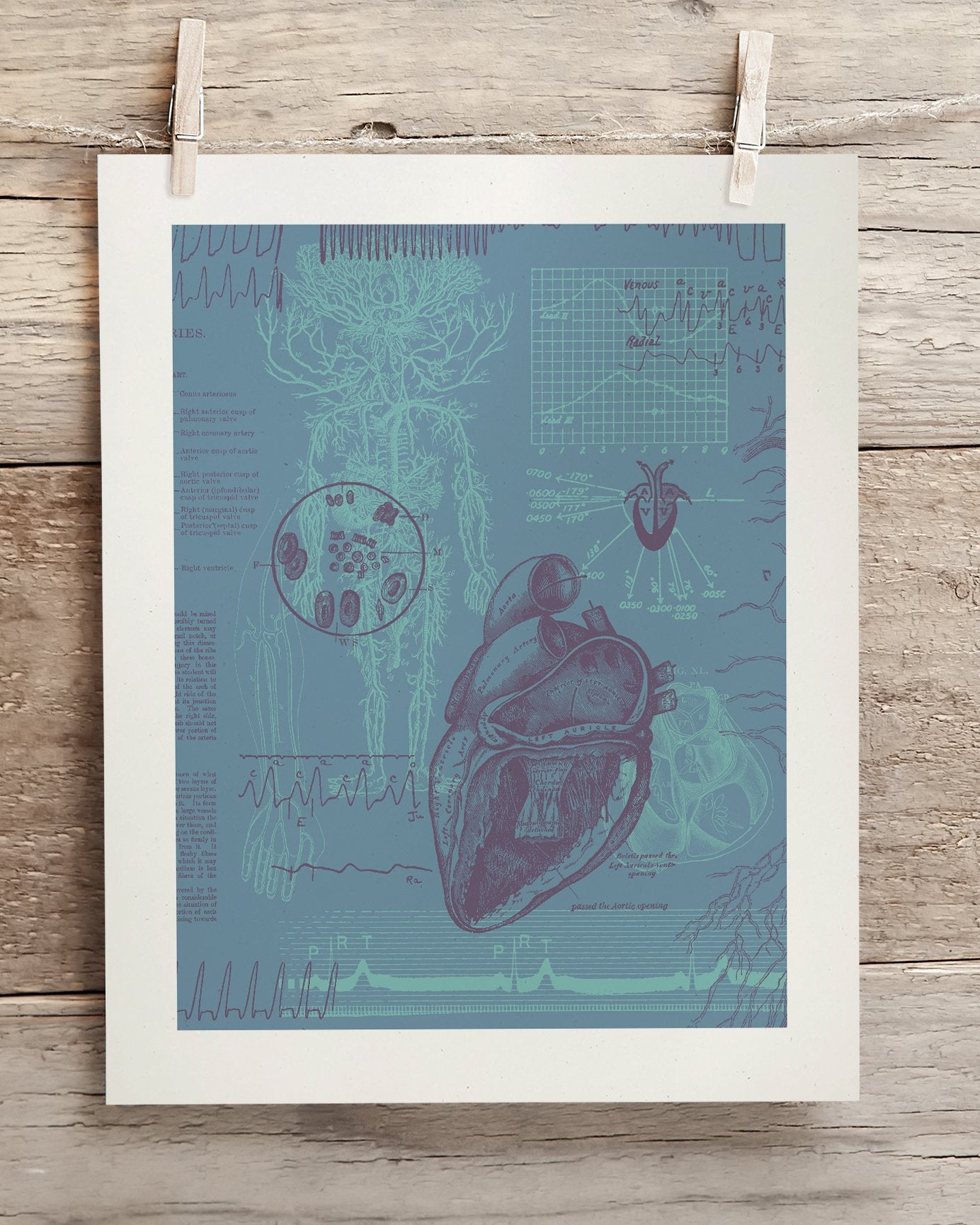 Cardiology Museum Print